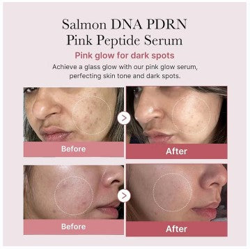 Medicube PDRN Pink Peptide Face Serum For Dark Spots 30ml